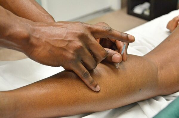 Akupunktur til behandling af sportsskader